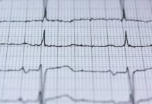 solar stream future pulse